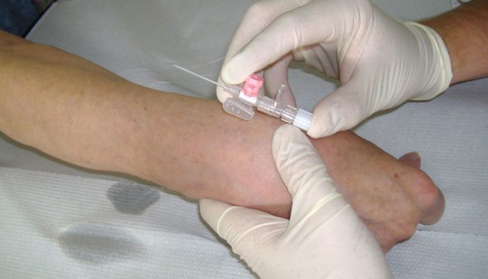 799px-Placement_of_intravenous_cannula_2